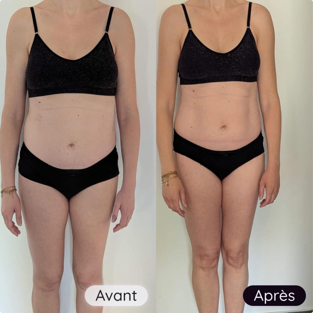 Avant et après cliente du programme coup de boost spécialisé péri-ménopause et ménopause de devant