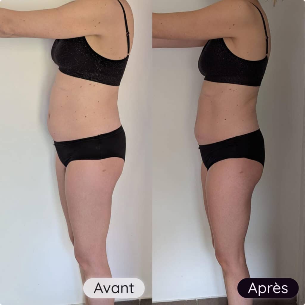 Avant et après cliente du programme coup de boost spécialisé péri-ménopause et ménopause sur le côté
